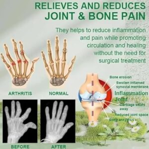 Bee Venom Pain Relief Cream